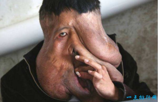 世界上最恶心的人 盘点世界上最丑最恶心的人 世界上最恶心的人 盘点世界上最丑最恶心的人